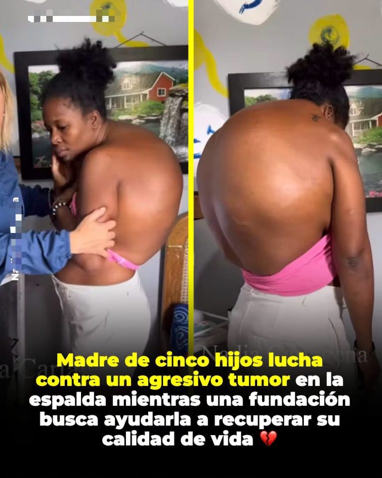 Jhoana enfrenta un tumor en la espalda mientras lucha por recuperarse y cuidar a sus cinco hijos