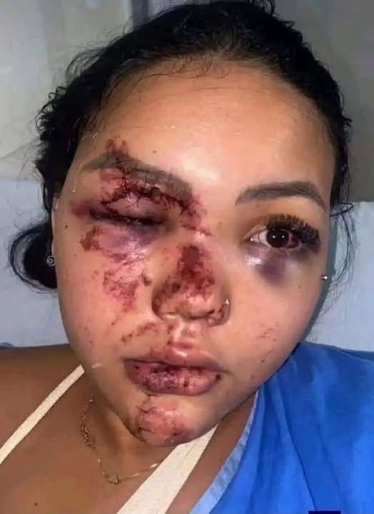 Mujer aparece con graves lesiones en el rostro y su historia genera preocupación en redes