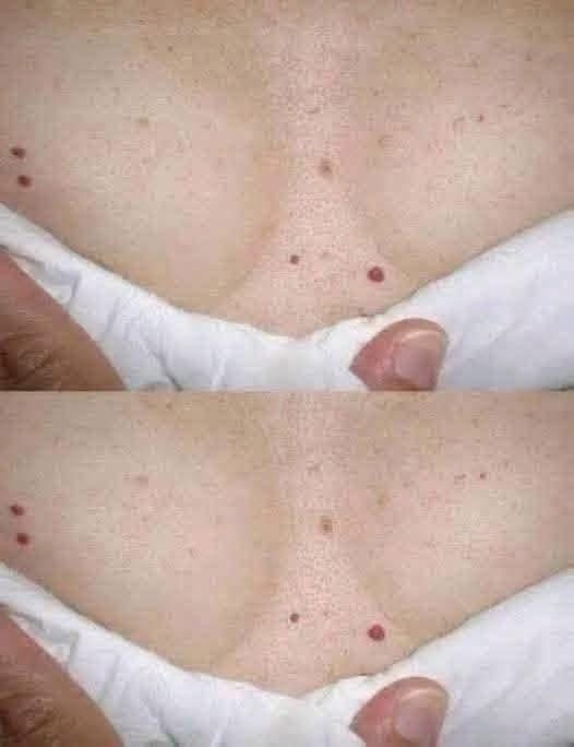 Puntos rojos en la piel: qué pueden significar y cuándo conviene prestarles atención