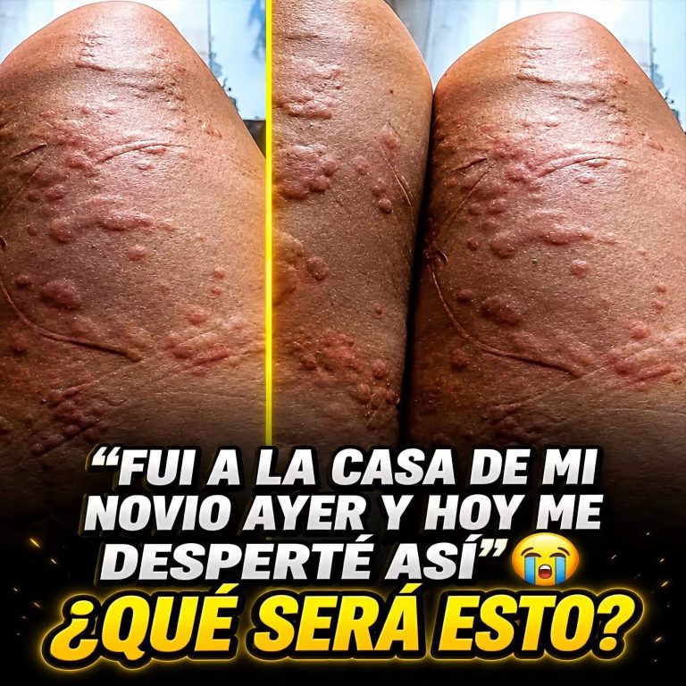 Hinchazón y cambio de color en la pierna: señales que no debes ignorar