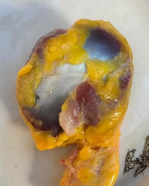 Comer mollejas de pollo puede aportar nutrientes importantes, pero no sustituye automáticamente ningún suplemento