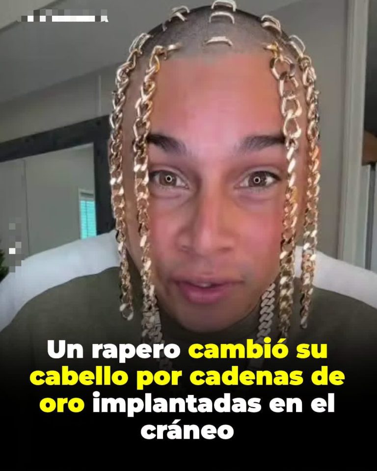 Dan Sur y su peculiar “pelo de oro”: el rapero que aseguró haberse implantado cadenas en la cabeza
